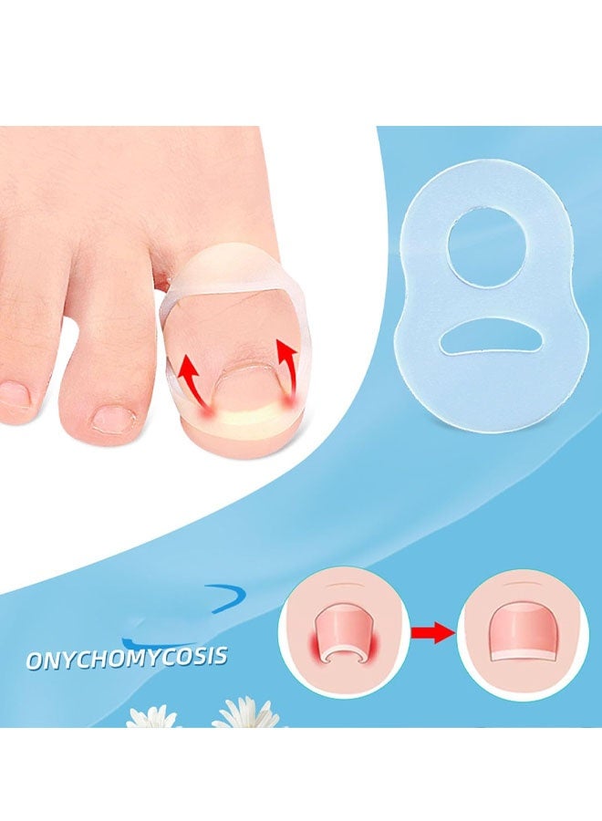 ١٠ قطع من حلقات تصحيح الأظافر الناشبة، حلقات سيليكون لتصحيح الأظافر الناشبة - مقاومة للتمدد، قابلة لإعادة الاستخدام - Image 5